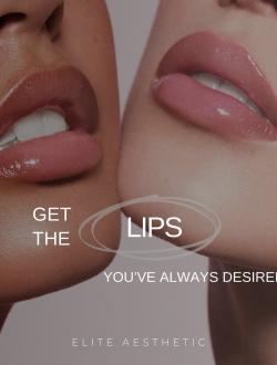 Tiêm Filler Uy Tín Quận 3 Tại 𝐄𝐥𝐢𝐭𝐞 𝐀𝐞𝐬𝐭𝐡𝐞𝐭𝐢𝐜 - TIÊM FILLER MÔI ĐẸP QUẬN 3