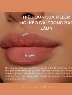 Hiệu Quả Tiêm Filler Kéo Dài Bao Lâu?