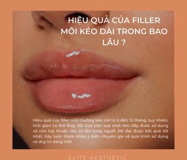 Hiệu Quả Tiêm Filler Kéo Dài Bao Lâu?
